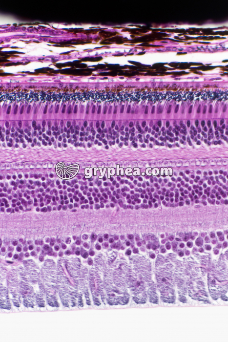 Rétine x100 - gryphea.org